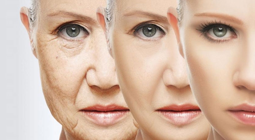 Acido Ialuronico o Botox?