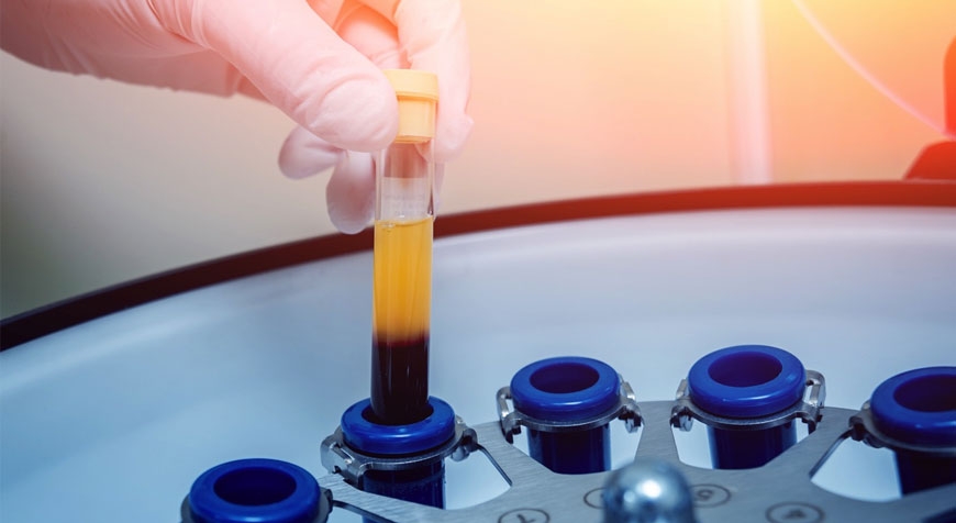 Quale PRP è efficace?