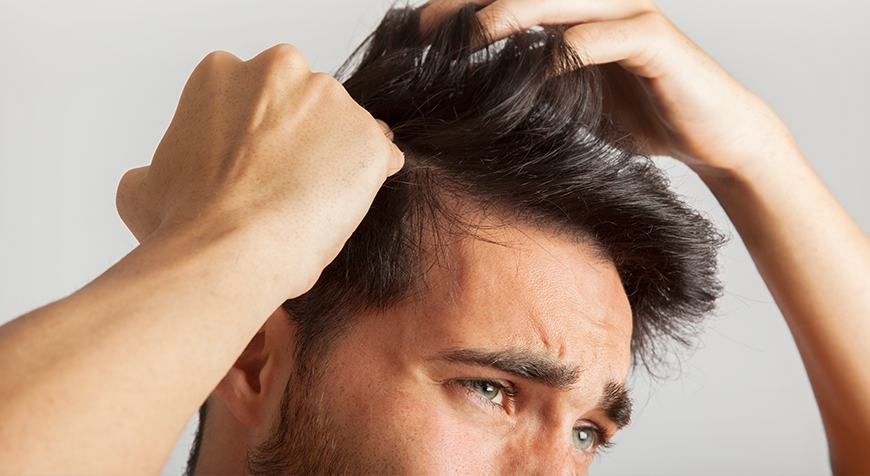 La soluzione definitiva per riavere i propri capelli &egrave; l'autotrapianto